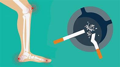 Can smoking cigarettes cause arthritis?