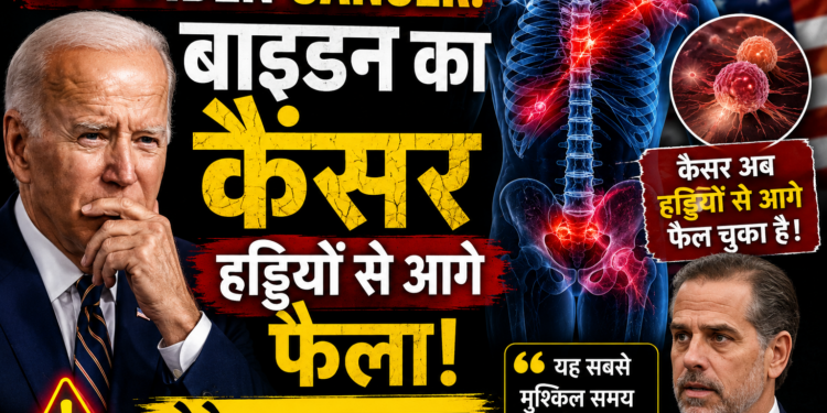 Joe Biden Cancer: बाइडन का कैंसर हड्डियों से आगे फैला, बेटे का खुलासा