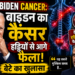 Joe Biden Cancer: बाइडन का कैंसर हड्डियों से आगे फैला, बेटे का खुलासा